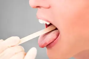 CPAP dry mouth