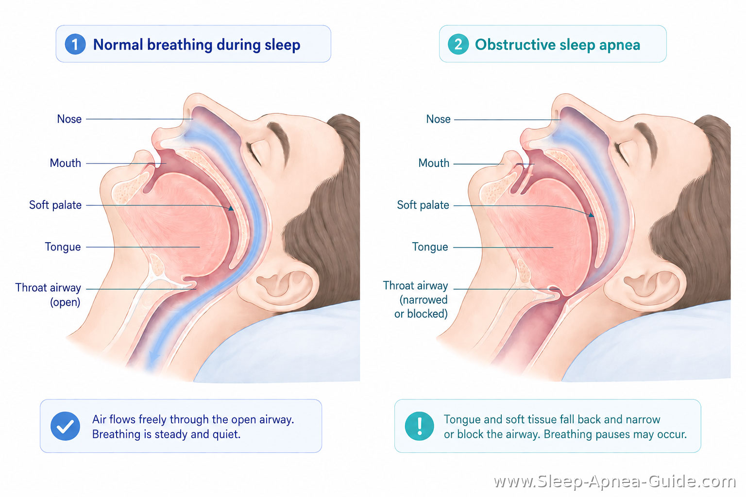 the mechanics of airway narrowing and collapse the mechanics of airway narrowing and collapse