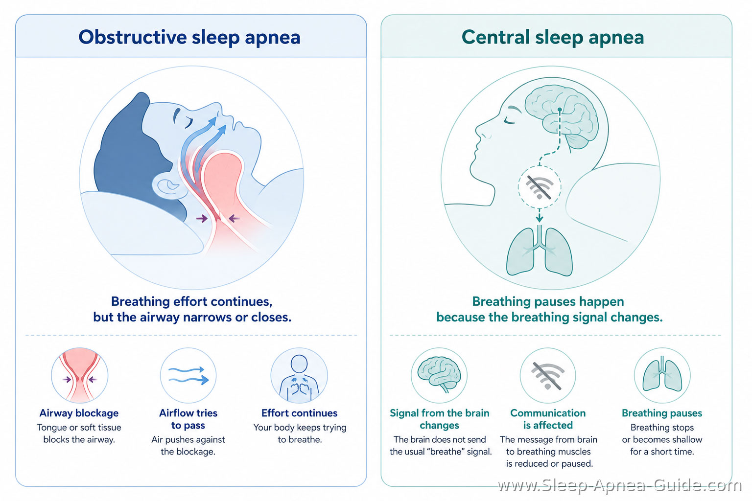 airway-collapse pattern vs brain-breathing-control pattern airway-collapse pattern vs brain-breathing-control pattern