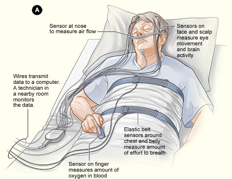 Image result for polysomnography